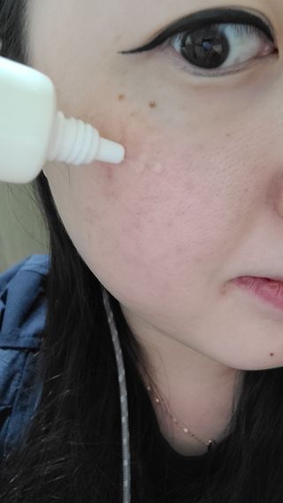 브에노 스킨셀 더마 앰플 — 5점을 준 리뷰어가 2021년 6월 올린 사용 사진