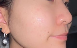 스킨큐어 산다화 비타민c 화이트닝 에센스 30ml — 4점을 준 리뷰어가 2023년 10월 올린 사용 사진