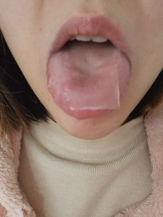 메디포스트 모비타 글루타치온 이지 필름형 30매 — 5점을 준 리뷰어가 2023년 1월 올린 사용 사진