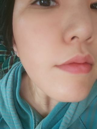 셀바이져 지우개 미스트 피부 보호 입주변 트러블 진정 케어 아기 안개분사 미스트 — 5점을 준 리뷰어가 2021년 3월 올린 사용 사진