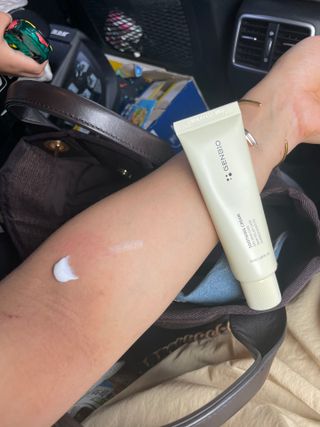 젠바이오 코스메틱스 젠바이오수딩크림]   가려운 피부 & 아토피 원픽 크림 — 5점을 준 리뷰어가 2022년 7월 올린 사용 사진