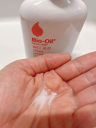 바이오오일 [바이오-오일] 바디 로션 175ml — 5점을 준 리뷰어가 2021년 10월 올린 사용 사진