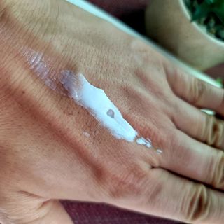 젠바이오 코스메틱스 젠바이오수딩크림]   가려운 피부 & 아토피 원픽 크림 — 5점을 준 리뷰어가 2022년 9월 올린 사용 사진