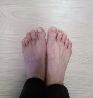 유케어 YOU CARE 문제성 손발톱케어_럭키풋 — 4점을 준 리뷰어가 2022년 10월 올린 사용 사진