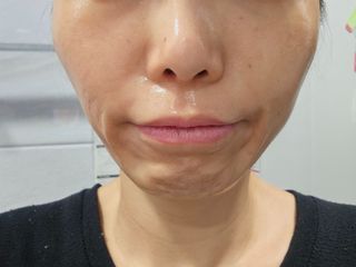 [밀리밀리] 콜라피 3D 마스크+콜라피 필링젤(본품증정) — 5점을 준 리뷰어가 2023년 12월 올린 사용 사진