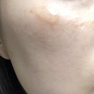 이엔코스 알부틴5프로화이트닝세럼 — 5점을 준 리뷰어가 2021년 2월 올린 사용 사진