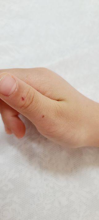 [큐어반H 커팅] 간편하게 떼서 쓰는 자외선차단 습윤밴드 (1팩/30매입) — 5점을 준 리뷰어가 2022년 12월 올린 사용 사진