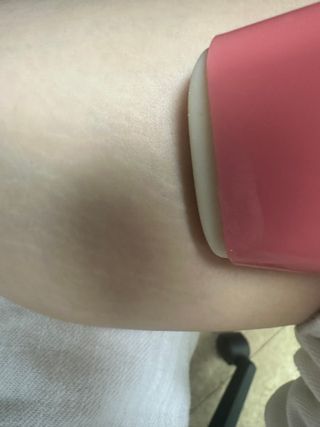 프리[원더에이드] 바디컷 스틱 — 3점을 준 리뷰어가 2024년 8월 올린 사용 사진