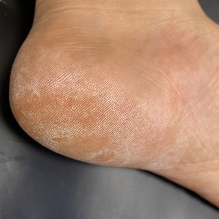 미라클풋 유리발각질제거기 물없이 쓱싹쓱싹 몇번만에 발각질 완벽제거 — 4.5점을 준 리뷰어가 2021년 10월 올린 사용 사진