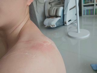 프리 [닥터문] 프리미엄 알로에베라 시카 수딩젤 1000ml — 5점을 준 리뷰어가 2024년 8월 올린 사용 사진