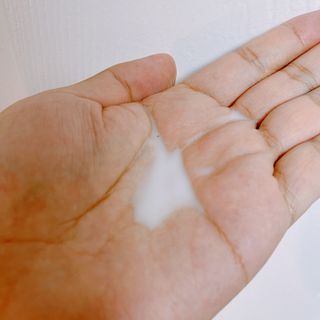 바이오오일 [바이오-오일] 바디 로션 175ml — 5점을 준 리뷰어가 2021년 10월 올린 사용 사진