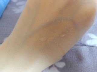 셀바이져 지우개 미스트 피부 보호 입주변 트러블 진정 케어 아기 안개분사 미스트 — 4.5점을 준 리뷰어가 2021년 3월 올린 사용 사진