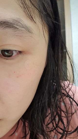 플리프 시카 알로에 스팟키트 — 5점을 준 리뷰어가 2021년 3월 올린 사용 사진