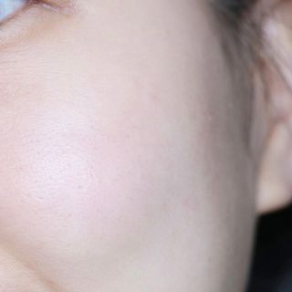 하이브리온 [쿠팡 구매평] 닥터초이스 멜라제로 스템셀 엑소좀 화이트닝 앰플 40g , 1개 — 5점을 준 리뷰어가 2025년 2월 올린 사용 사진