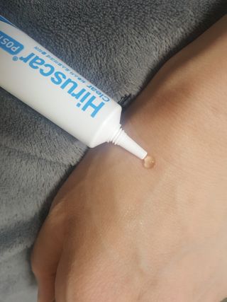 히루스카 포스트아크네 클리어 — 5점을 준 리뷰어가 2021년 1월 올린 사용 사진