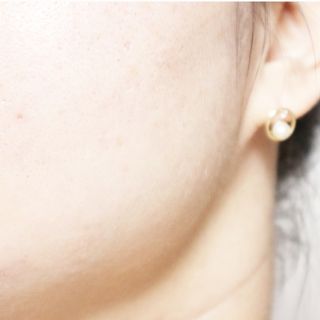 랑팡 EGF+FGF 10ppm 리포좀 앰플 원액 10ml — 5점을 준 리뷰어가 2021년 11월 올린 사용 사진
