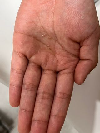 닥터시드 티트리 앤 라임 비건 지성케어 쿨 탈모 두피 워터 스케일러 — 5점을 준 리뷰어가 2024년 4월 올린 사용 사진