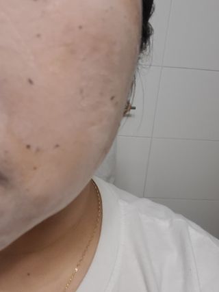 프롬노시베 로지 클레이 버블 팩 — 5점을 준 리뷰어가 2022년 1월 올린 사용 사진