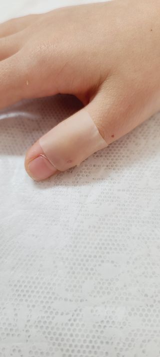 [큐어반H 커팅] 간편하게 떼서 쓰는 자외선차단 습윤밴드 (1팩/30매입) — 5점을 준 리뷰어가 2022년 12월 올린 사용 사진