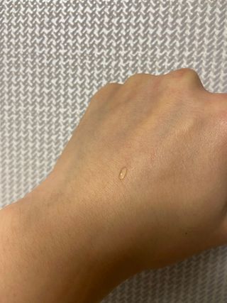히루스카 포스트아크네 클리어 — 5점을 준 리뷰어가 2021년 1월 올린 사용 사진