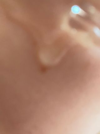 베지톨로지 비니페린 브라이트닝 앰플 — 5점을 준 리뷰어가 2022년 8월 올린 사용 사진