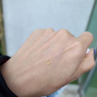 히루스카 포스트아크네 클리어 — 4점을 준 리뷰어가 2021년 1월 올린 사용 사진