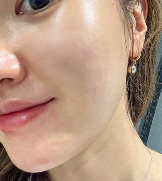 스킨큐어 산다화 카멜리아 안티 링클 멀티밤 — 5점을 준 리뷰어가 2022년 1월 올린 사용 사진