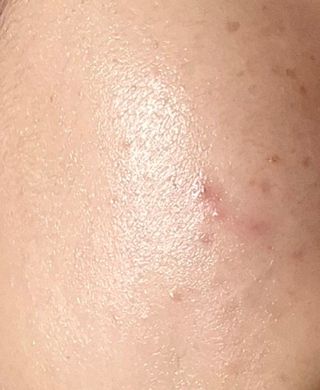 MF[스킨1004] 마다가스카르 센텔라 앰플 100ml — 5점을 준 리뷰어가 2024년 5월 올린 사용 사진
