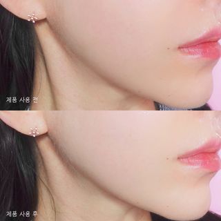 아이디플라코스메틱 아이디 페이스핏 마이너스 밴드 v2 — 5점을 준 리뷰어가 2022년 5월 올린 사용 사진