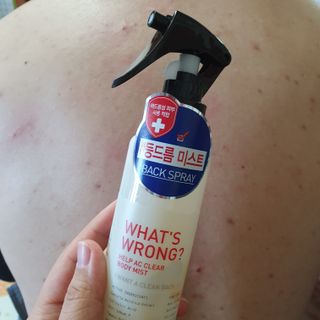 [후르디아] 등드름 잡는 바디 미스트 2개 세트 — 5점을 준 리뷰어가 2021년 6월 올린 사용 사진