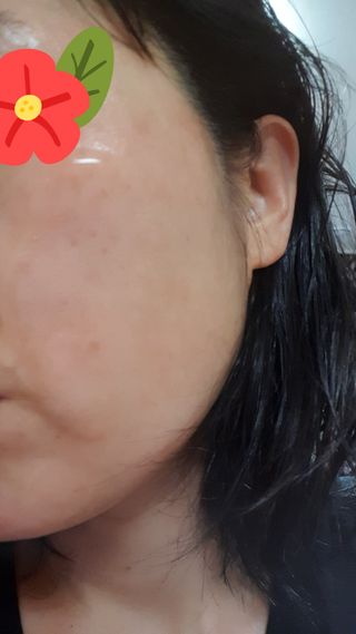 아이앤립 / EYENLIP 아이앤립 24K 골드 N 펩타이드 앰플 크림 — 4점을 준 리뷰어가 2021년 6월 올린 사용 사진