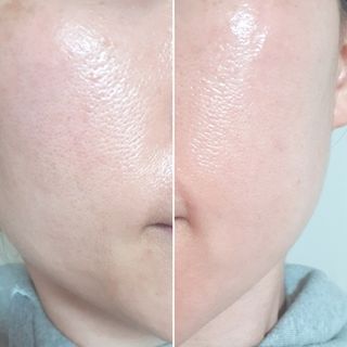 바노바기 코스메틱 피디알엔 리페어 리얼 밤 9g — 5점을 준 리뷰어가 2023년 9월 올린 사용 사진