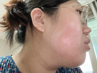 ✅프리 [밀리밀리] 메디 앰플 콜라 15ml — 5점을 준 리뷰어가 2025년 9월 올린 사용 사진