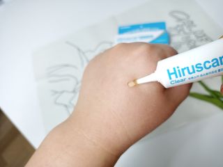히루스카 포스트아크네 클리어 — 5점을 준 리뷰어가 2021년 1월 올린 사용 사진