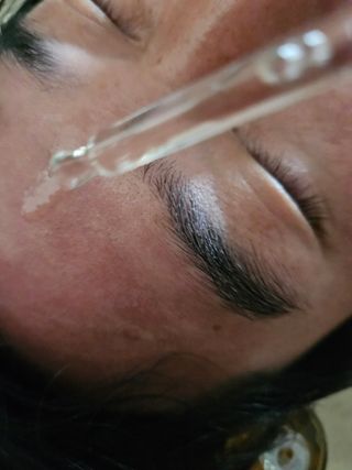 [스킨1004] 마다가스카르 센텔라 앰플 100ml — 5점을 준 리뷰어가 2024년 5월 올린 사용 사진