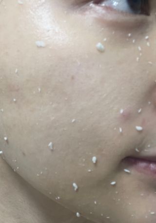 [후르디아] 아보카도 비건 약산성 효소필링젤 — 5점을 준 리뷰어가 2024년 2월 올린 사용 사진
