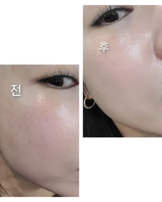 스킨큐어 산다화 카멜리아 안티 링클 멀티밤 — 5점을 준 리뷰어가 2022년 4월 올린 사용 사진
