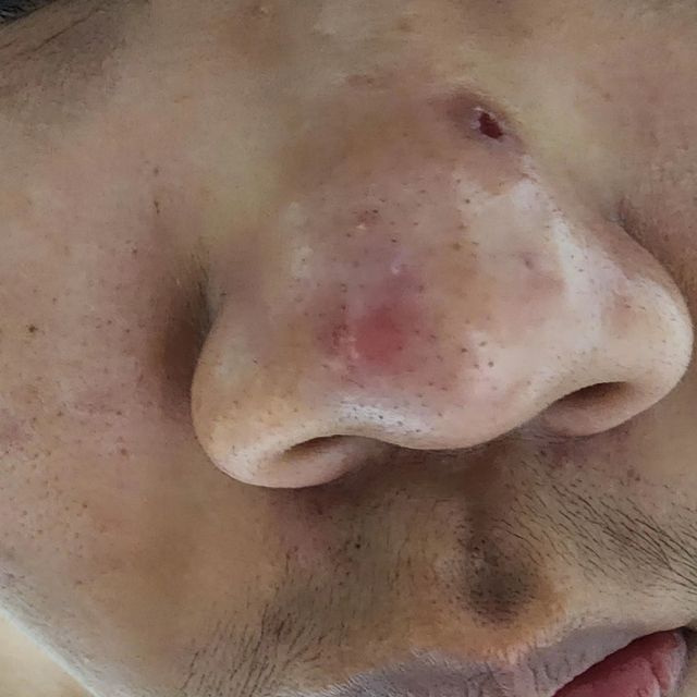세뚜아 스티키 포어 패치 Cettua Sticky Pore Patch 리뷰 사진