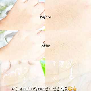 리더스코스메틱 리더스 스텝솔루션 티트리 릴렉싱 토너 패드 — 4.5점을 준 리뷰어가 2022년 4월 올린 사용 사진