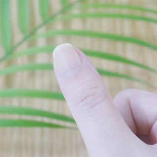 유케어 YOU CARE 문제성 손발톱케어_럭키풋 — 4.5점을 준 리뷰어가 2022년 10월 올린 사용 사진