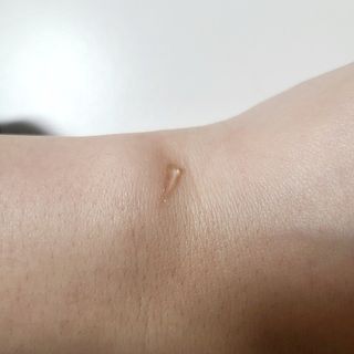히루스카 포스트아크네 클리어 — 5점을 준 리뷰어가 2021년 3월 올린 사용 사진