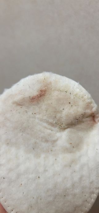 디어엘로디 무표백 021패드  12개세트 — 5점을 준 리뷰어가 2022년 9월 올린 사용 사진