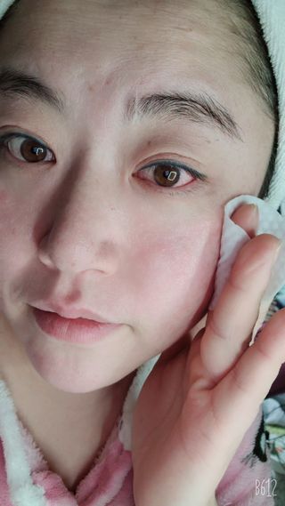 팜스테이 티트리 바이옴 카밍 토너 패드 — 5점을 준 리뷰어가 2022년 4월 올린 사용 사진