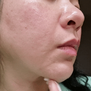 메이쿱 로우 소스 더 비건 에센스 100ml — 4점을 준 리뷰어가 2022년 4월 올린 사용 사진