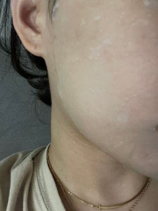 닥터마시멜로 닥터마스멜로 마블러스 아쿠아 클리닉 마스크 — 5점을 준 리뷰어가 2021년 7월 올린 사용 사진