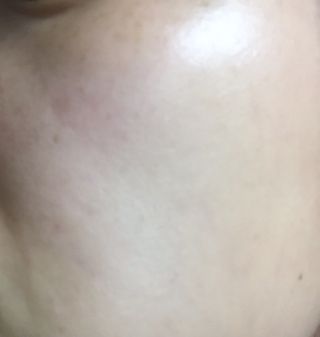 아이앤립 / EYENLIP 아이앤립 24K 골드 N 펩타이드 앰플 크림 — 5점을 준 리뷰어가 2021년 3월 올린 사용 사진