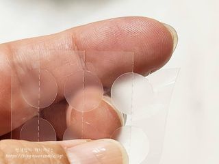 세뚜아(Cettua) 세뚜아 스팟 클리어 듀얼 패치 Cettua Spot Clear Dual Patch — 5점을 준 리뷰어가 2023년 8월 올린 사용 사진