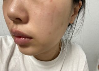 브에노 파리퀸 윌 페이스 오일 — 5점을 준 리뷰어가 2021년 8월 올린 사용 사진
