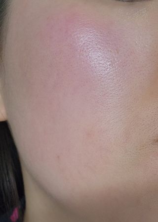 MF[스킨1004] 마다가스카르 센텔라 앰플 100ml — 5점을 준 리뷰어가 2024년 5월 올린 사용 사진