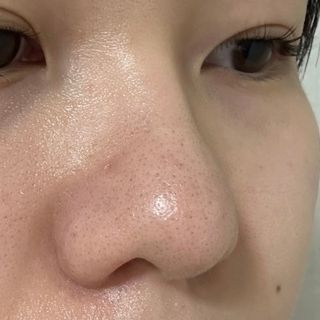 세뚜아(Cettua) 세뚜아 스티키 포어 패치 Cettua Sticky Pore Patch — 5점을 준 리뷰어가 2023년 9월 올린 사용 사진